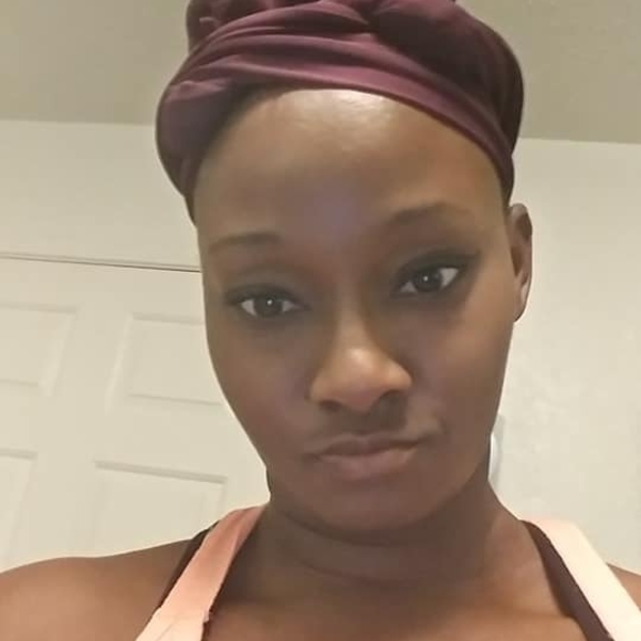 tashara_burns